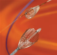 Carotid WALLSTENT with FilterWire