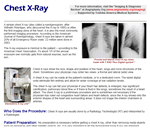 Chest X-Ray