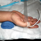 IVUS image showing stent under-expansion
