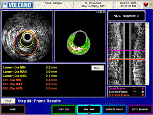 Virtual Histology Screen Shot