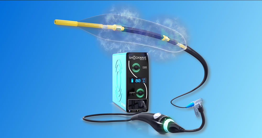 Shockwave Medical and Genesis MedTech Obtain Regulatory Approval in China for Intravascular Lithotripsy - Vimarsana News