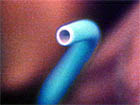 tip of ordinary hollow catheter